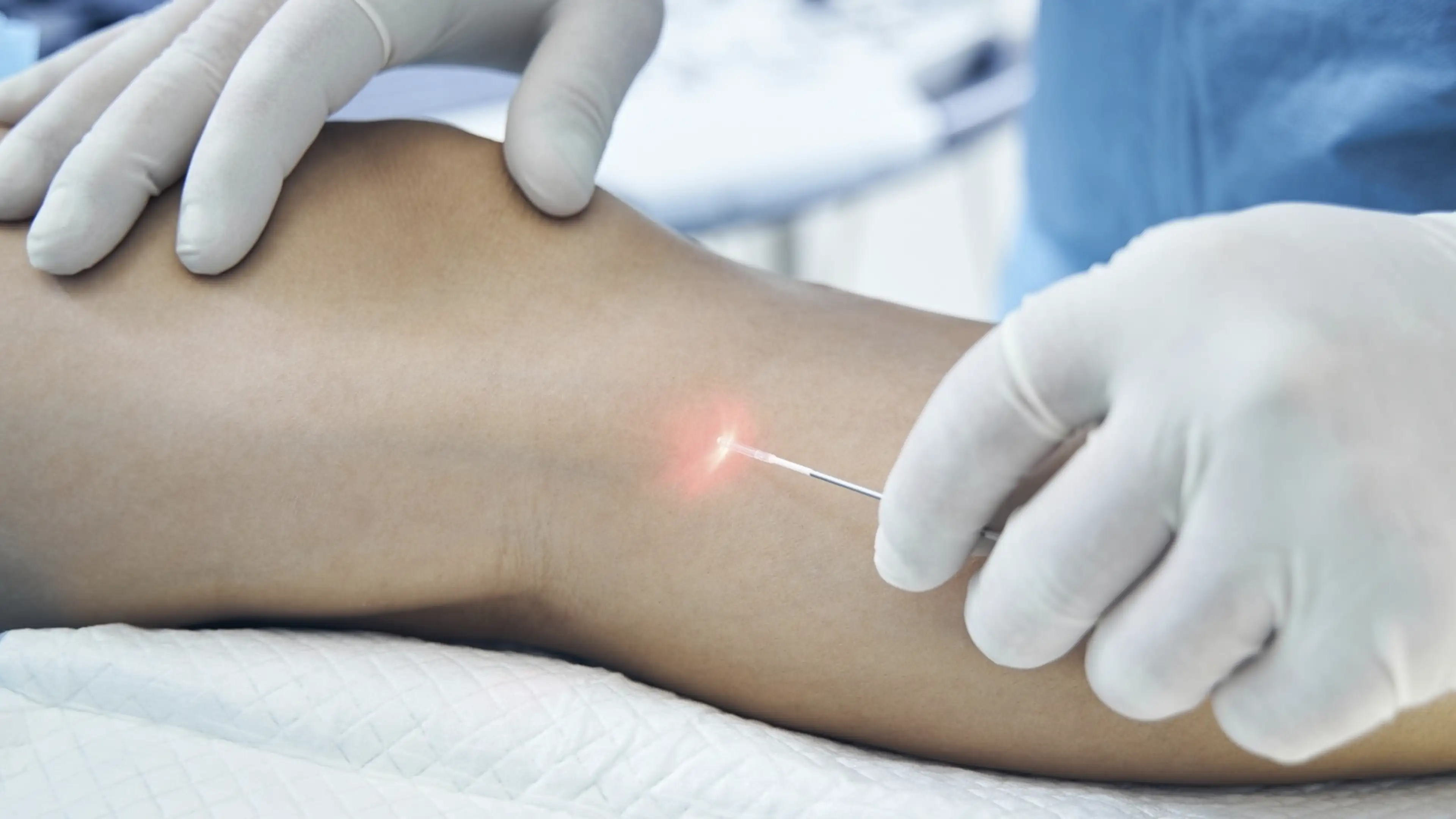 Cirurgião Vascular em Florianópolis