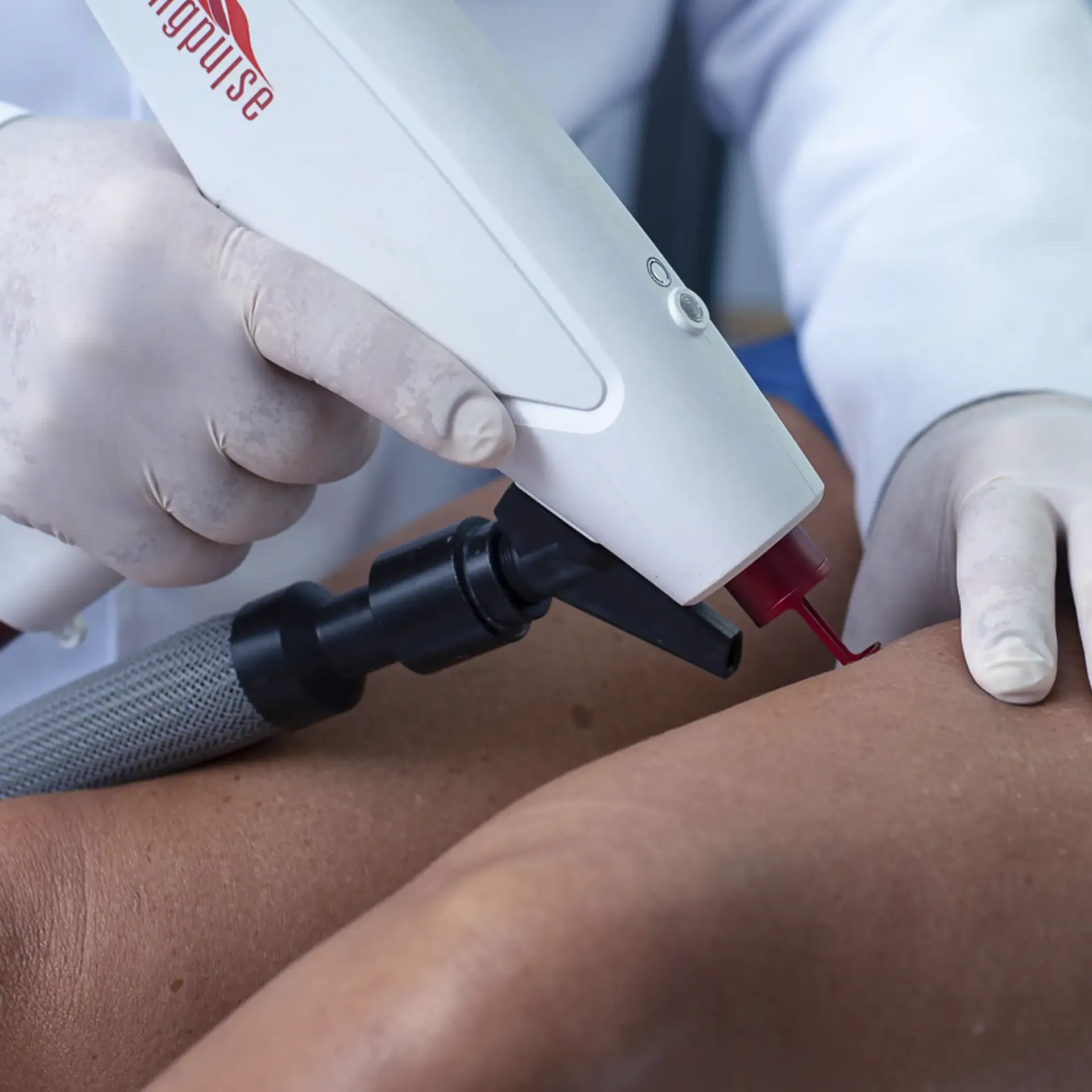 Laser Transdérmico Florianópolis